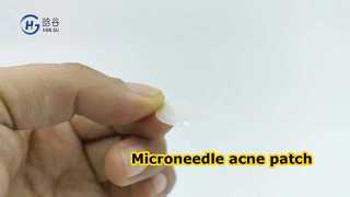Microneedle acne patch